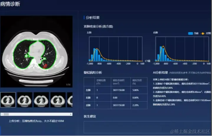 我的AI学习之旅年度总结